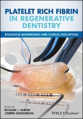 Miron / Choukroun | Platelet Rich Fibrin in Regenerative Dentistry | E-Book | sack.de