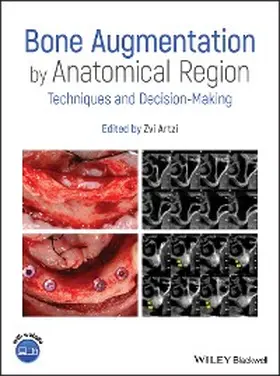 Artzi | Bone Augmentation by Anatomical Region | E-Book | www.sack.de