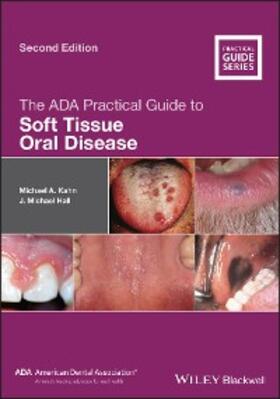 Kahn / Hall |  The ADA Practical Guide to Soft Tissue Oral Disease | eBook | Sack Fachmedien
