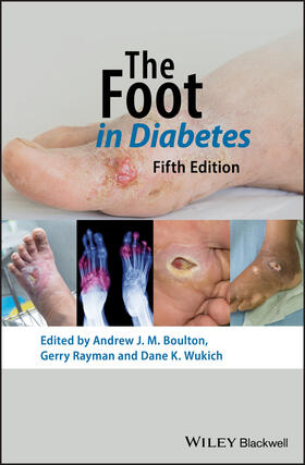Boulton / Rayman / Wukich |  The Foot in Diabetes | Buch |  Sack Fachmedien