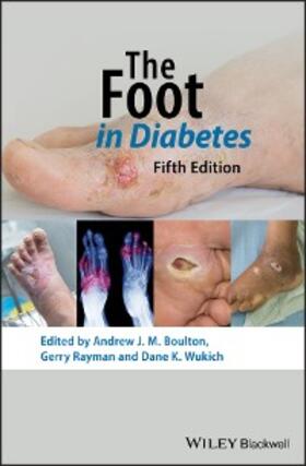 Boulton / Rayman / Wukich |  The Foot in Diabetes | eBook | Sack Fachmedien