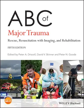 Driscoll / Skinner / Goode | ABC of Major Trauma | Buch | 978-1-119-49885-8 | sack.de