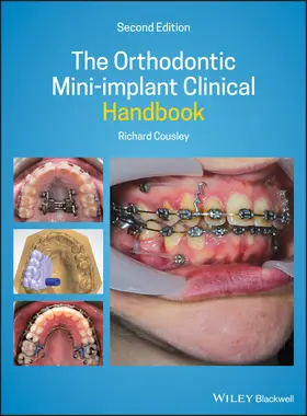 Cousley | The Orthodontic Mini-Implant Clinical Handbook | Buch | 978-1-119-50975-2 | www.sack.de