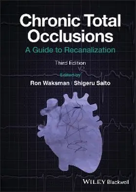 Waksman / Saito |  Chronic Total Occlusions | eBook | Sack Fachmedien
