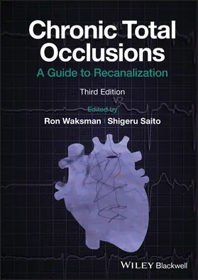 Waksman / Saito |  Chronic Total Occlusions | Buch |  Sack Fachmedien