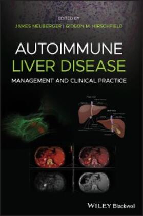 Neuberger / Hirschfield | Autoimmune Liver Disease | E-Book | sack.de