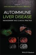 Neuberger / Hirschfield |  Autoimmune Liver Disease | eBook | Sack Fachmedien
