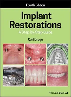 Drago | Implant Restorations | E-Book | www.sack.de