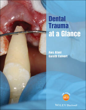 Alani / Calvert | Dental Trauma at a Glance | Buch | 978-1-119-56283-2 | sack.de