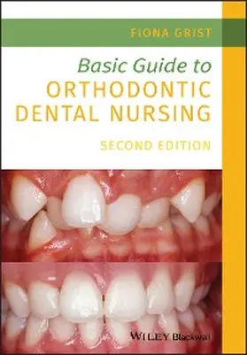 Grist |  Basic Guide to Orthodontic Dental Nursing | eBook | Sack Fachmedien