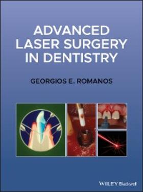 Romanos |  Advanced Laser Surgery in Dentistry | eBook | Sack Fachmedien