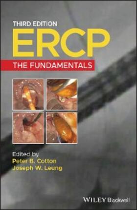 Cotton / Leung |  ERCP | eBook | Sack Fachmedien