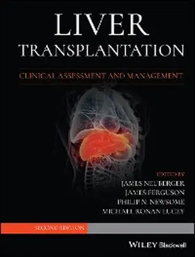 Neuberger / Ferguson / Newsome |  Liver Transplantation | eBook | Sack Fachmedien