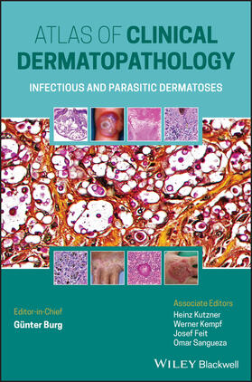 Kutzner / Kempf / Feit | Atlas of Clinical Dermatopathology | Buch | 978-1-119-64706-5 | sack.de