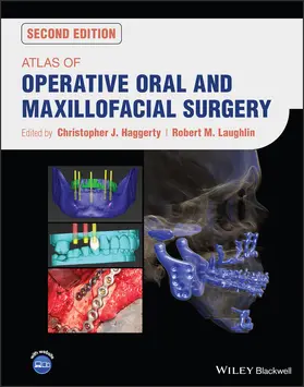 Haggerty / Laughlin | Atlas of Operative Oral and Maxillofacial Surgery | Buch | 978-1-119-68381-0 | sack.de