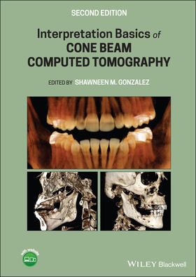 Gonzalez | Interpretation Basics of Cone Beam Computed Tomography | Buch | sack.de
