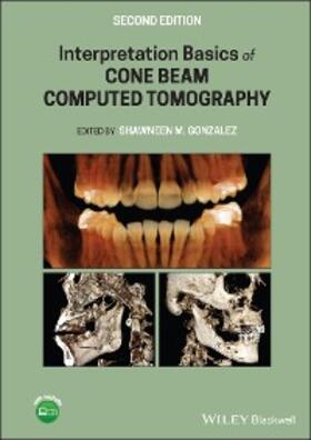 Gonzalez | Interpretation Basics of Cone Beam Computed Tomography | E-Book | www.sack.de