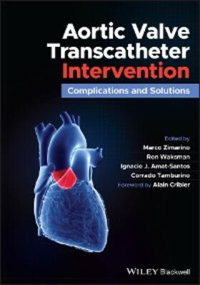 Zimarino / Waksman / Amat-Santos | Aortic Valve Transcatheter Intervention | E-Book | www.sack.de