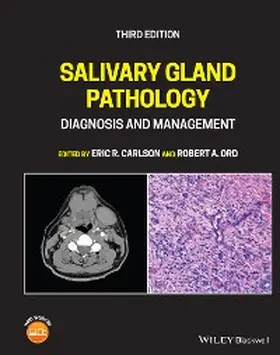 Carlson / Ord | Salivary Gland Pathology | E-Book | www.sack.de
