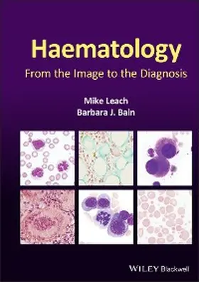 Leach / Bain |  Haematology | eBook | Sack Fachmedien