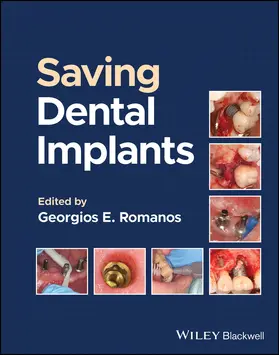 Romanos |  Saving Dental Implants | Buch |  Sack Fachmedien