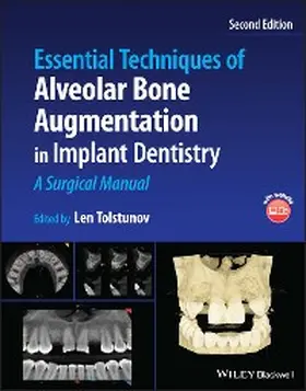 Tolstunov |  Essential Techniques of Alveolar Bone Augmentation in Implant Dentistry | eBook | Sack Fachmedien