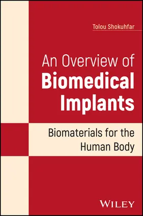 Shokuhfar |  An Overview of Biomedical Implants | Buch |  Sack Fachmedien