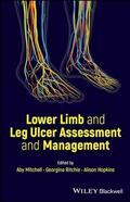 Mitchell / Hopkins / Ritchie |  Lower Limb and Leg Ulcer Assessment and Management | Buch |  Sack Fachmedien