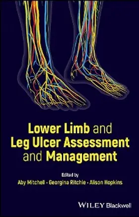 Mitchell / Ritchie / Hopkins |  Lower Limb and Leg Ulcer Assessment and Management | eBook | Sack Fachmedien