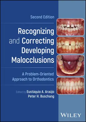 Araújo / Buschang | Recognizing and Correcting Developing Malocclusions | Buch | 978-1-119-91254-5 | sack.de