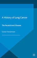 Timmermann |  A History of Lung Cancer | eBook | Sack Fachmedien