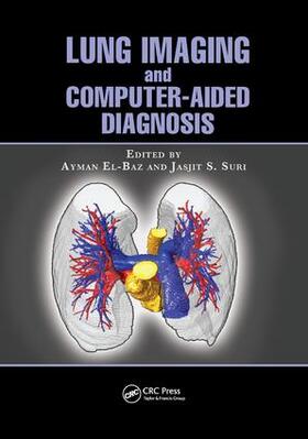 El-Baz / Suri | Lung Imaging and Computer Aided Diagnosis | Buch | 978-1-138-07207-7 | sack.de