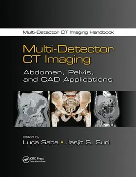 Saba / Suri |  Multi-Detector CT Imaging | Buch |  Sack Fachmedien
