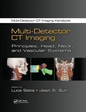 Saba / Suri |  Multi-Detector CT Imaging | Buch |  Sack Fachmedien