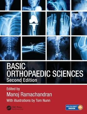 Ramachandran | Basic Orthopaedic Sciences | Buch | 978-1-138-09172-6 | sack.de