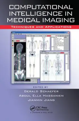 Schaefer / Hassanien / Jiang | Computational Intelligence in Medical Imaging: Techniques and Applications | Buch | 978-1-138-11220-9 | sack.de