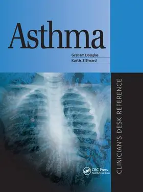 Douglas / Elward | Asthma | Buch | 978-1-138-11346-6 | sack.de