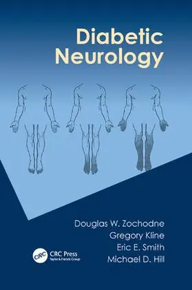 Zochodne / Kline / Smith | Diabetic Neurology | Buch | 978-1-138-11364-0 | www.sack.de