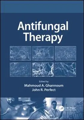Ghannoum / Perfect, MD |  Antifungal Therapy | Buch |  Sack Fachmedien