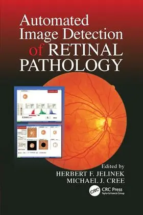 Jelinek / Cree |  Automated Image Detection of Retinal Pathology | Buch |  Sack Fachmedien