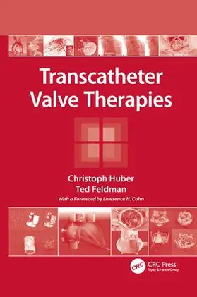Huber / Feldman | Transcatheter Valve Therapies | Buch | 978-1-138-11610-8 | www.sack.de