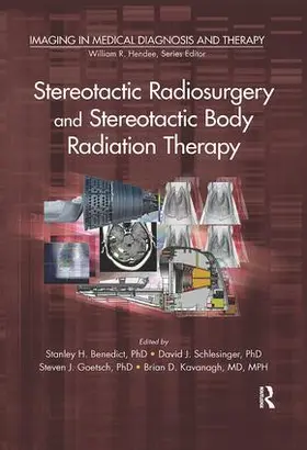 Benedict / J. Schlesinger / Goetsch |  Stereotactic Radiosurgery and Stereotactic Body Radiation Therapy | Buch |  Sack Fachmedien