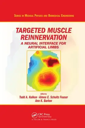 Kuiken / Schultz Feuser / Barlow |  Targeted Muscle Reinnervation | Buch |  Sack Fachmedien