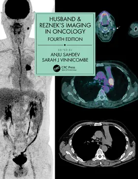 Sahdev / Vinnicombe | Husband & Reznek's Imaging in Oncology | Buch | 978-1-138-30123-8 | www.sack.de