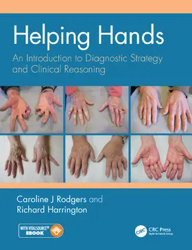 Rodgers / Harrington |  Helping Hands: An Introduction to Diagnostic Strategy and Clinical Reasoning | Buch |  Sack Fachmedien