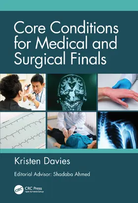 Davies | Core Conditions for Medical and Surgical Finals | Buch | 978-1-138-33103-7 | www.sack.de