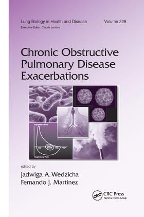 Wedzicha / Martinez |  Chronic Obstructive Pulmonary Disease Exacerbations | Buch |  Sack Fachmedien