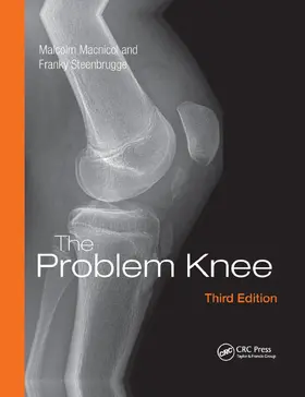 Macnicol / Steenbrugge |  The Problem Knee | Buch |  Sack Fachmedien