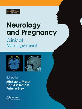 Marsh / Nashef / Brex | Neurology and Pregnancy | Buch | 978-1-138-37247-4 | sack.de