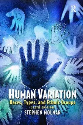 Molnar |  Human Variation | Buch |  Sack Fachmedien